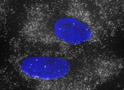 GAPDH in A549 Cells