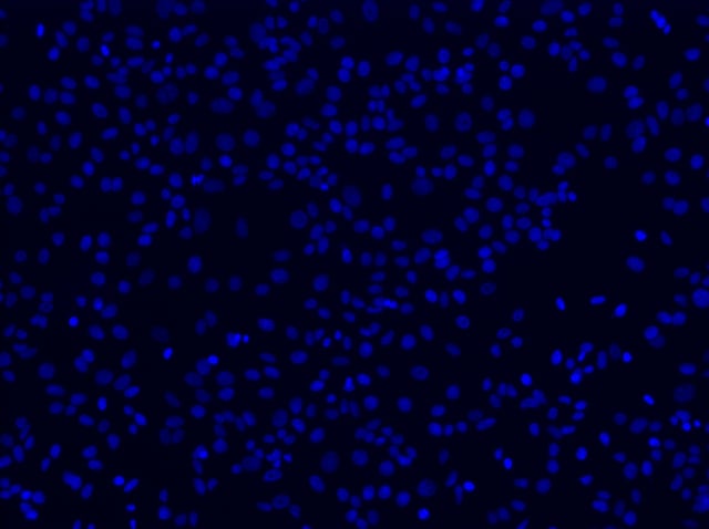 10x-dapi-blue-mk167.jpg