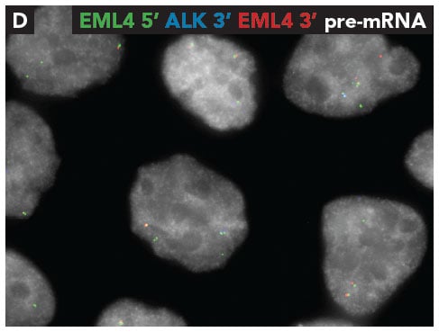 eml4-alk-pre-mrna.jpg