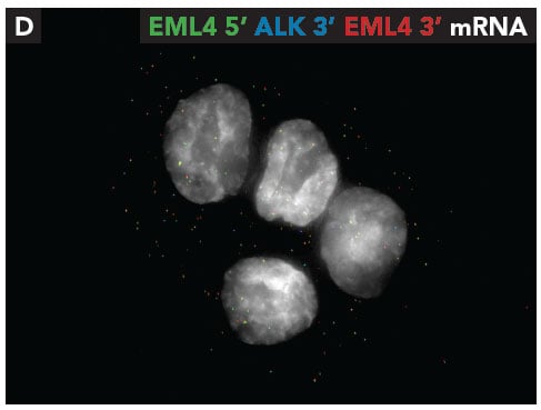 eml4-alk3-mrna.jpg