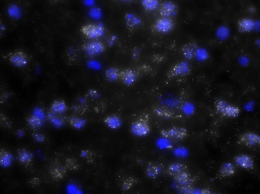 Unraveling the Neural  Stellaris® RNA FISH