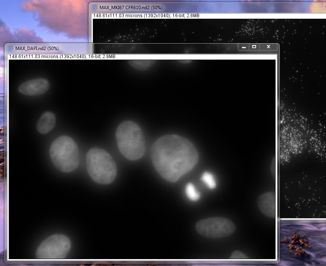 imagej-maxip-dapi-mk167-mcf7-cells.png